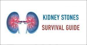 The Kidney Stones Survival Guide